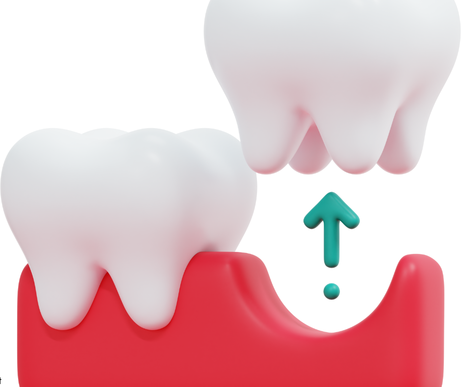 Tooth Extractions in Cincinnati