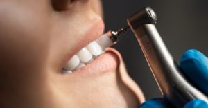 Cincinnati Dental Cleanings