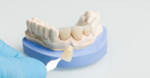 Dental Crown