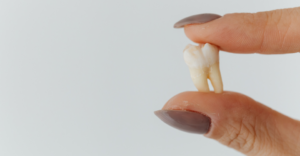Tooth Extractions